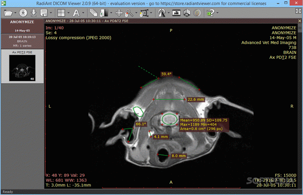 RadiAnt DICOM Viewer Crack With Serial Number Latest